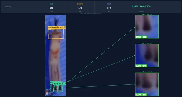 Screen showing the computer-vision model detecting graft anatomy